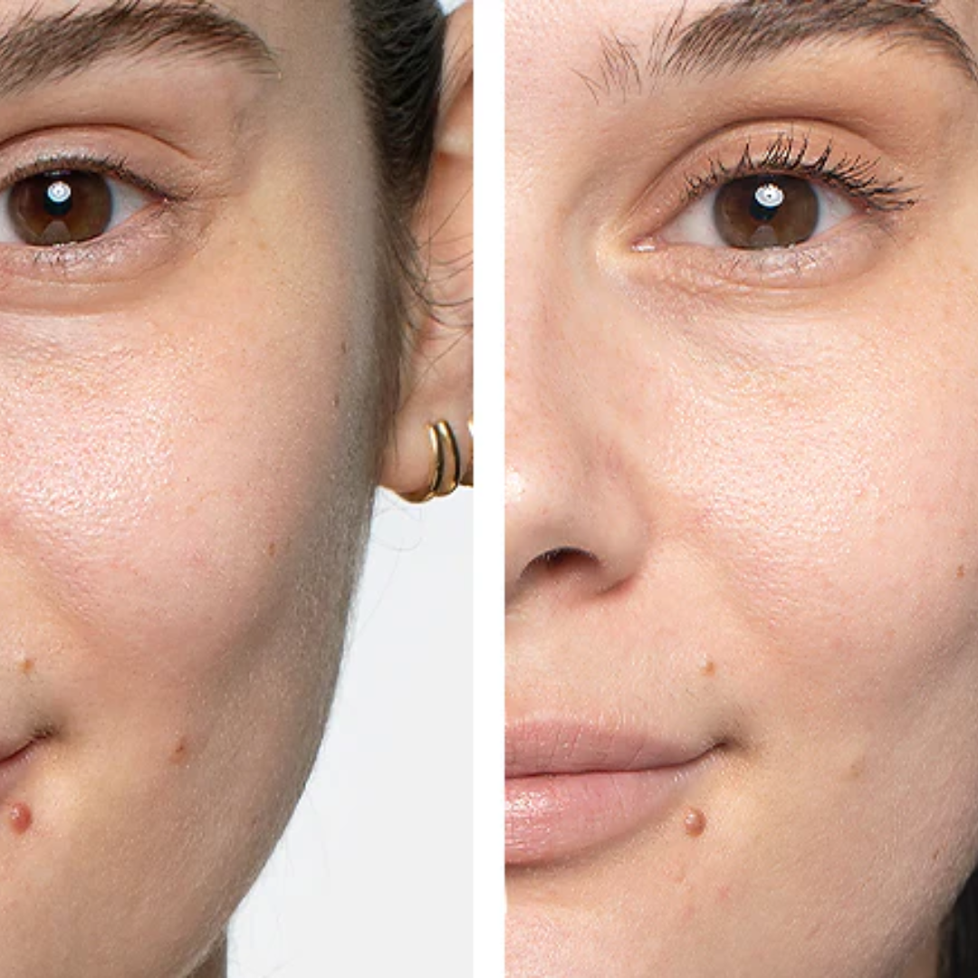 Torriden Cellmazing Pore Perfecting Ampoule | Smooths, Tightens & Hydrates Pores | Improves 8 Pore Concerns