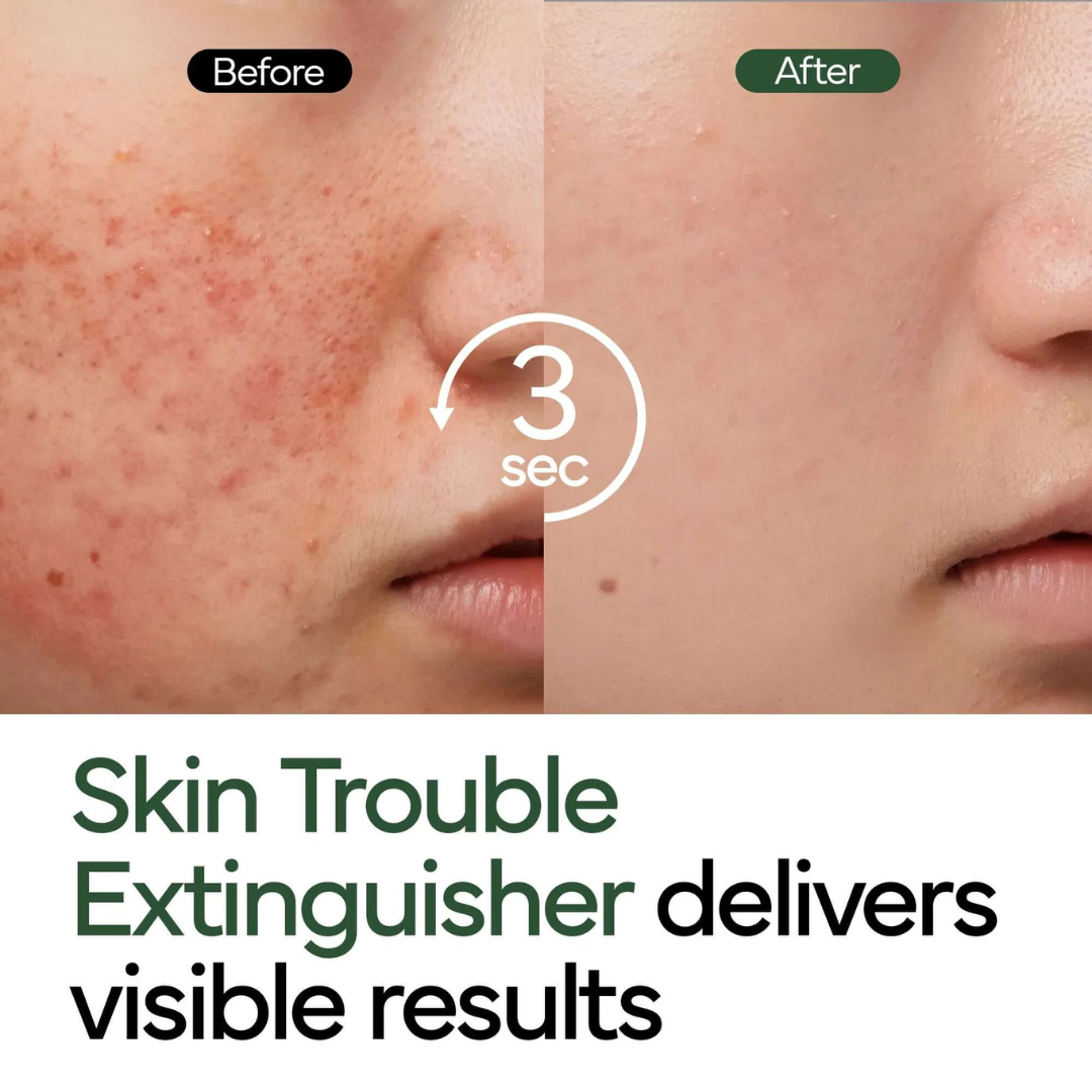 Ivoskin Intensive Cica Repair Cream | 85% Naturally Derived with Madecassoside, Ceramides & Hyaluronic Acid | Calms Redness, Clears Acne & Repairs Skin Barrier