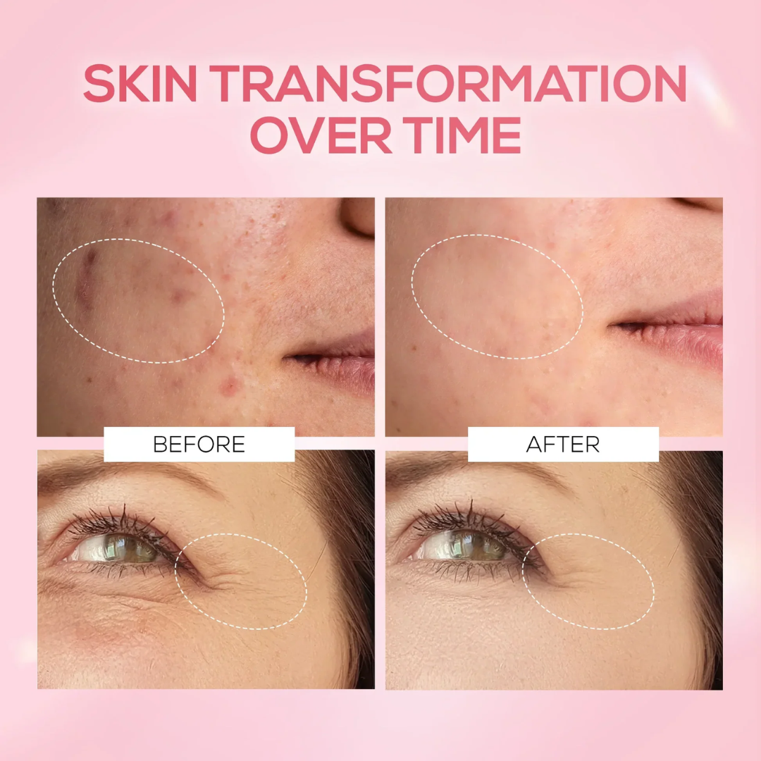 PDRN Volume Booster Cream | 15,000ppm PDRN + Retinal + Peptides | Wrinkle Repair, Skin Firming & Youthful Volume