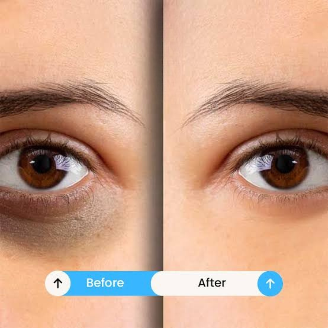 Naturalize Hyaluron Eye Roll-On – Anti-Puffiness & Dark Circles – Brighter, Smoother & Younger Eyes – With Hyaluronic Acid & Cooling Metal Roller – Reduces Dark Circles, Puffiness & Fine Lines