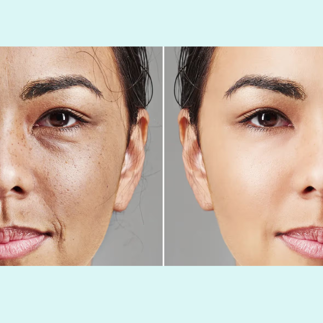 Anua PDRN 100 Hyaluronic Acid Hydrating Capsule Mist | Deep Moisture + Youthful Glow, Plumping & Glass Skin Mist