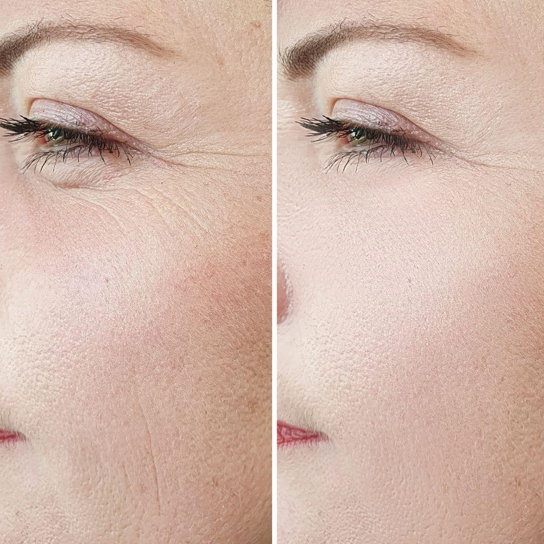 Highfy Beauty Retinol 0.5% Serum | Anti-Aging, Boosts Collagen, Reduces Fine Lines & Wrinkles | Brightens & Smooths Skin