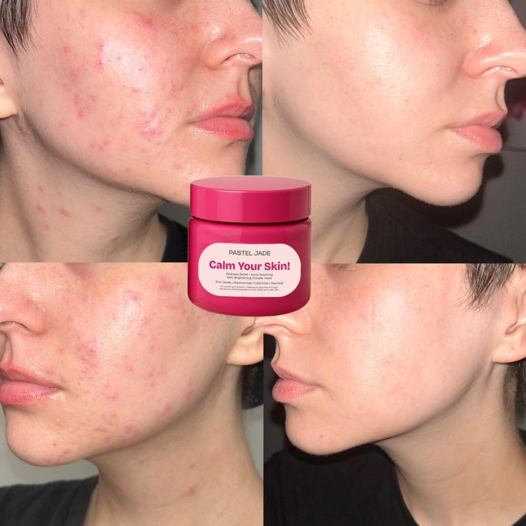 Pastel Jade Calm Your Skin Brightening Powder Mask | Redness Relief, Acne Soothing & Oil Control
