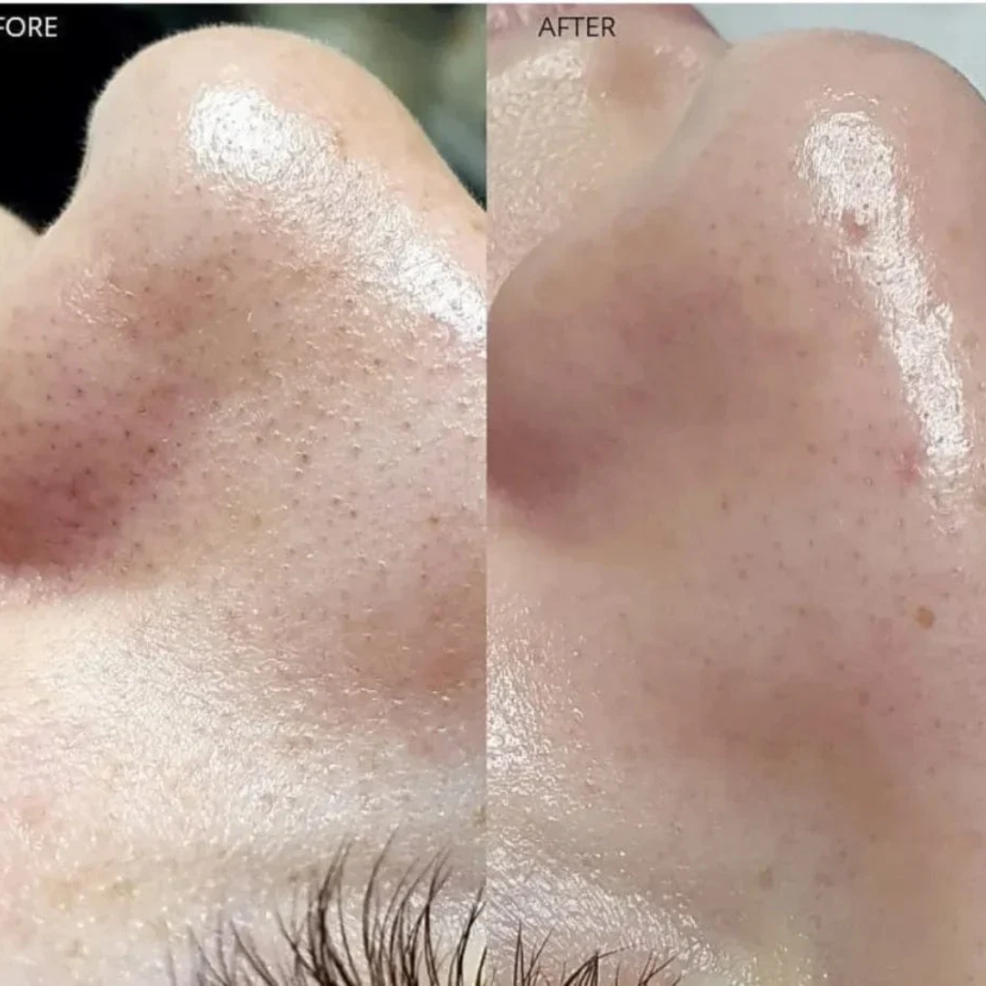 Torriden Cellmazing Pore Perfecting Ampoule | Smooths, Tightens & Hydrates Pores | Improves 8 Pore Concerns