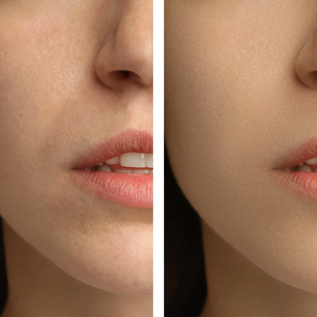 Anua Crystal Glow Duo: Rice Enzyme Brightening Cleansing Powder & PDRN Collagen Capsule Mist | Deep Hydration + Glass Skin Set