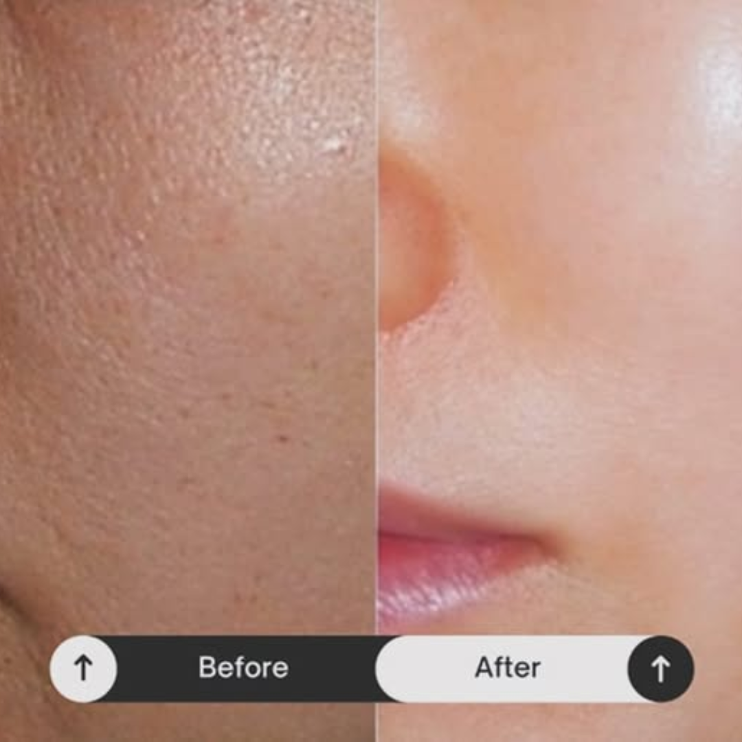 PDRN Volume Booster Cream | 15,000ppm PDRN + Retinal + Peptides | Wrinkle Repair, Skin Firming & Youthful Volume