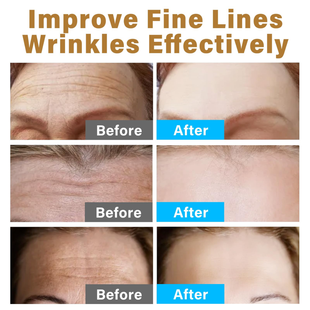 Highfy Beauty Retinol 0.5% Serum | Anti-Aging, Boosts Collagen, Reduces Fine Lines & Wrinkles | Brightens & Smooths Skin