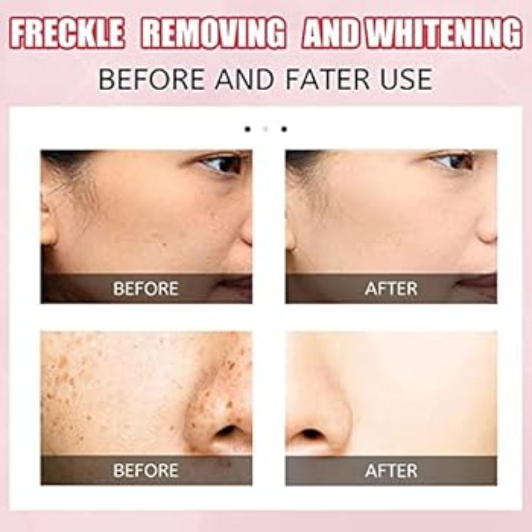 Celimax Whitening Cream - Reduce Dark Spots & Pigmentation | Minimize Open Pores
