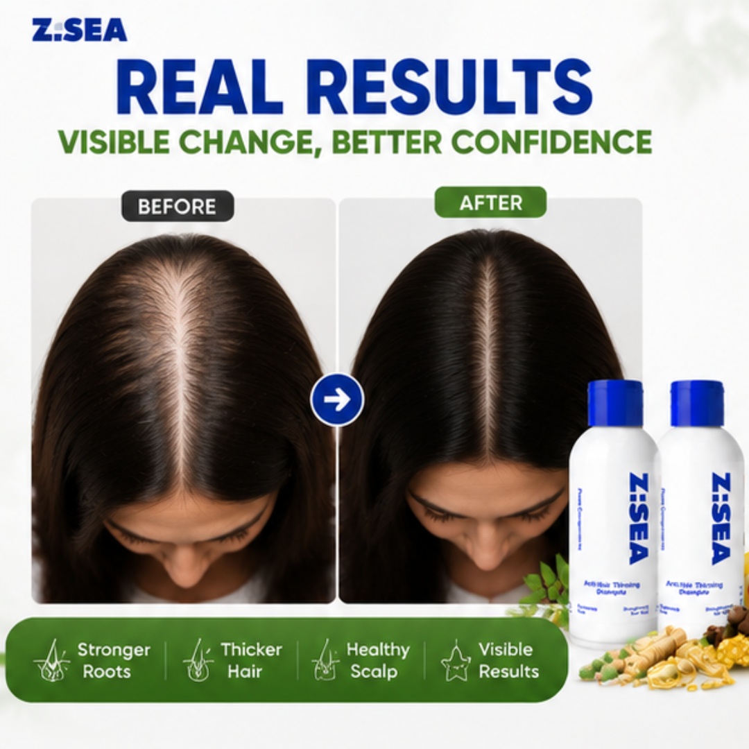 Z.SEA Herbal Shampoo – Anti-Hair Thinning – Stronger Roots, Thicker Hair Naturally – Reduces Hair Fall, Nourishes Scalp – Sulfate-Free & Paraben-Free – For Men & Women