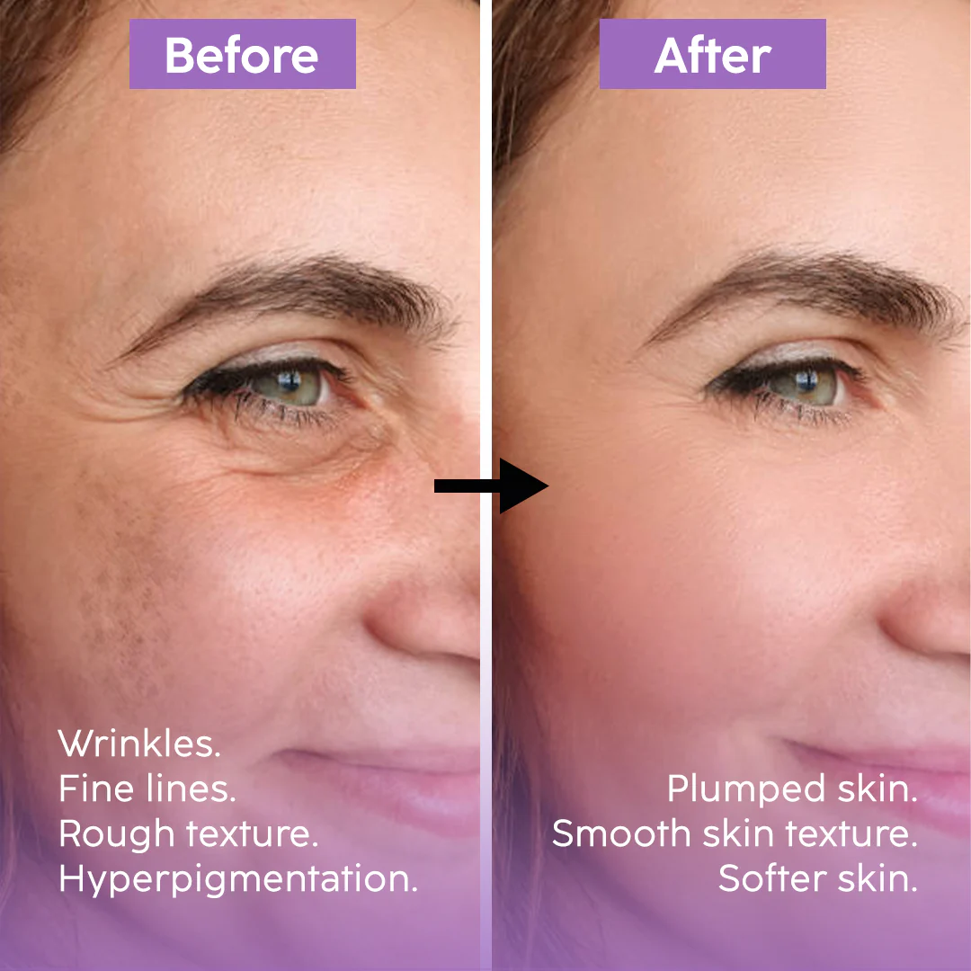 Highfy Beauty Retinol 0.5% Serum | Anti-Aging, Boosts Collagen, Reduces Fine Lines & Wrinkles | Brightens & Smooths Skin