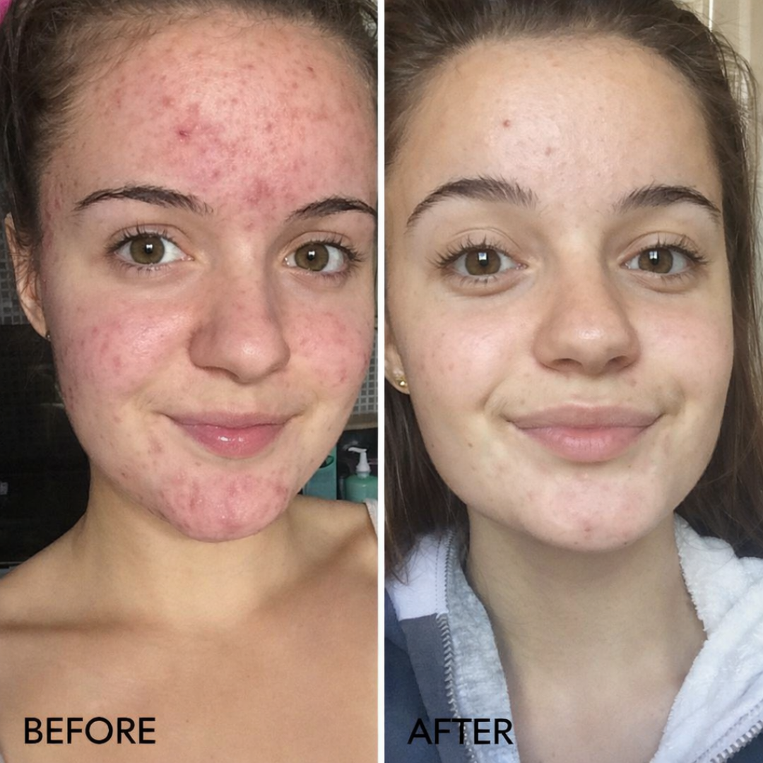 Pastel Jade Calm Your Skin Brightening Powder Mask | Redness Relief, Acne Soothing & Oil Control