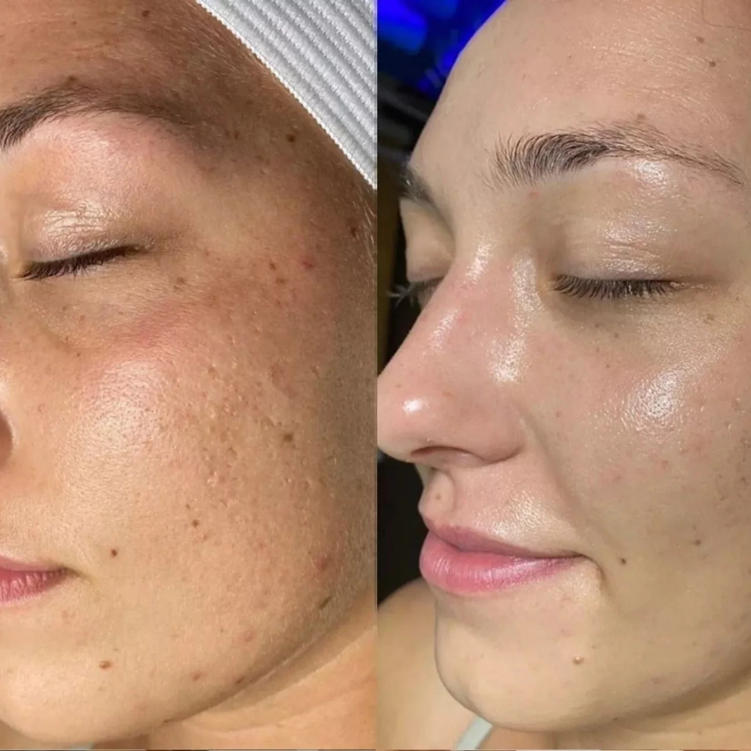 Torriden Cellmazing Pore Perfecting Ampoule | Smooths, Tightens & Hydrates Pores | Improves 8 Pore Concerns