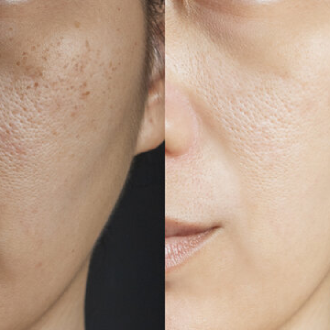 PDRN Volume Booster Cream | 15,000ppm PDRN + Retinal + Peptides | Wrinkle Repair, Skin Firming & Youthful Volume