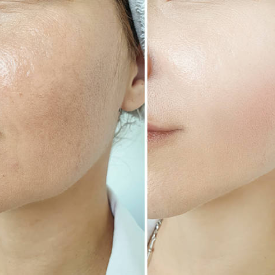 PDRN Volume Booster Cream | 15,000ppm PDRN + Retinal + Peptides | Wrinkle Repair, Skin Firming & Youthful Volume