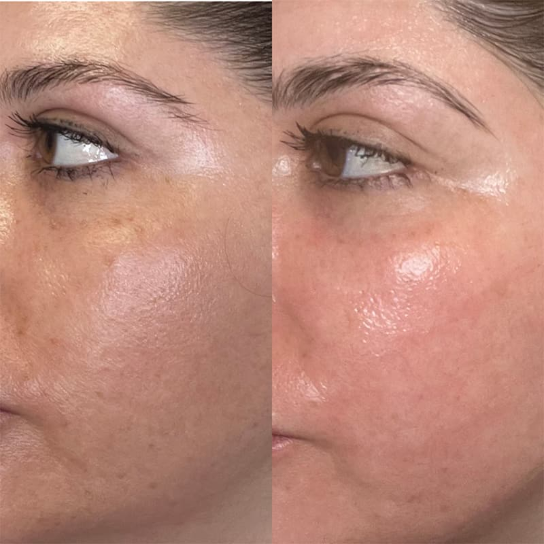 KINUI Calm-7 Soothing Serum | 7 Skin-Perfecting Ingredients with 3 Types of CICA, PDRN, Niacinamide, Panthenol & Tea Tree | Pore Control, Oil Balance & Pigmentation Care