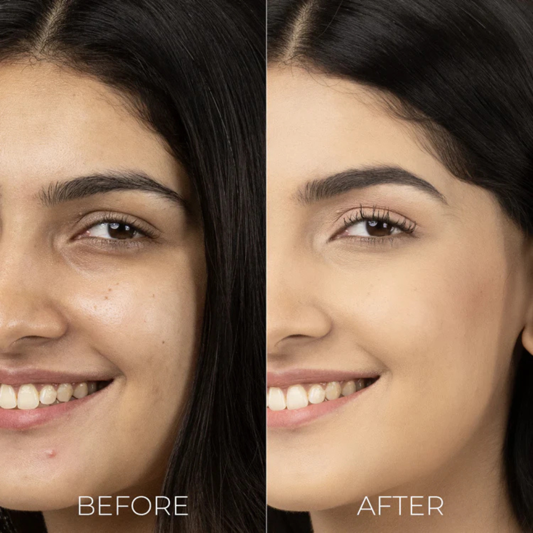 Melaglow Rich Depigmentation & Glow Restoration Cream – Reduces Dark Spots & Pigmentation, Evens Skin Tone, Boosts Natural Glow – Safe & Gentle for Daily Use – For Brighter, Even-Toned Healthy Skin