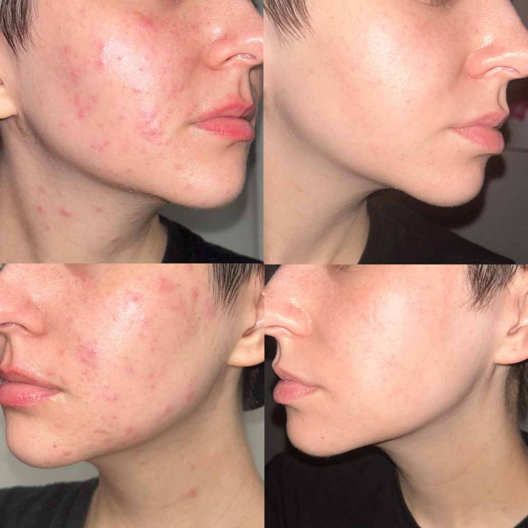 Highfy Beauty Retinol 0.5% Serum | Anti-Aging, Boosts Collagen, Reduces Fine Lines & Wrinkles | Brightens & Smooths Skin