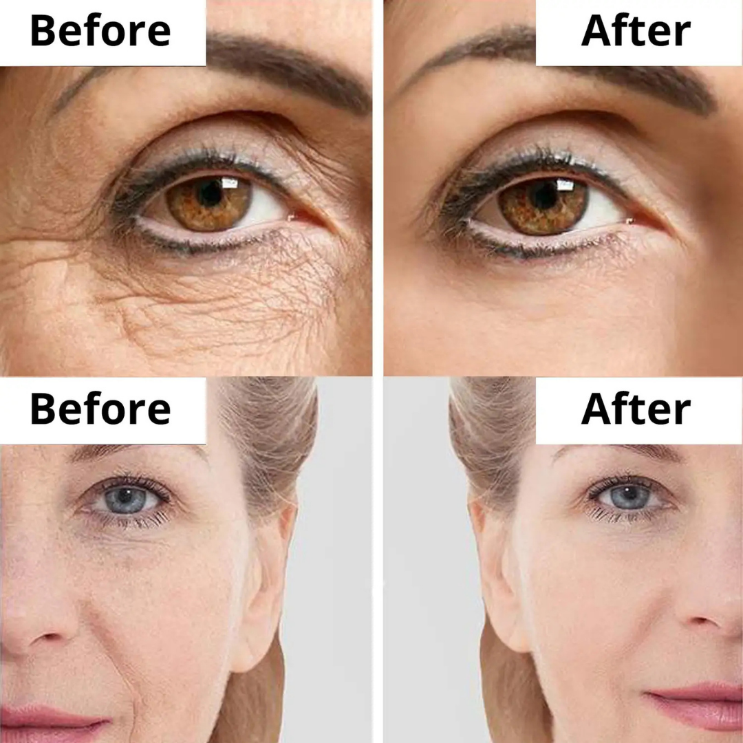Highfy Beauty Retinol 0.5% Serum | Anti-Aging, Boosts Collagen, Reduces Fine Lines & Wrinkles | Brightens & Smooths Skin