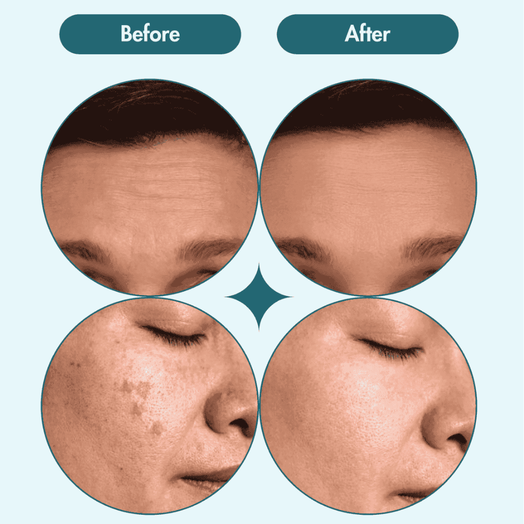 Ivoskin Intensive Cica Repair Cream | 85% Naturally Derived with Madecassoside, Ceramides & Hyaluronic Acid | Calms Redness, Clears Acne & Repairs Skin Barrier