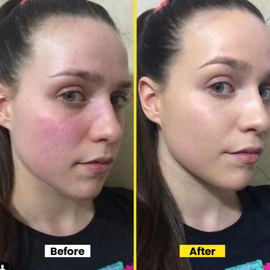 Melaglow Rich Depigmentation & Glow Restoration Cream – Reduces Dark Spots & Pigmentation, Evens Skin Tone, Boosts Natural Glow – Safe & Gentle for Daily Use – For Brighter, Even-Toned Healthy Skin