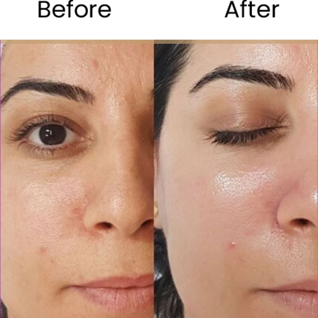 Ivoskin Intensive Cica Repair Cream | 85% Naturally Derived with Madecassoside, Ceramides & Hyaluronic Acid | Calms Redness, Clears Acne & Repairs Skin Barrier