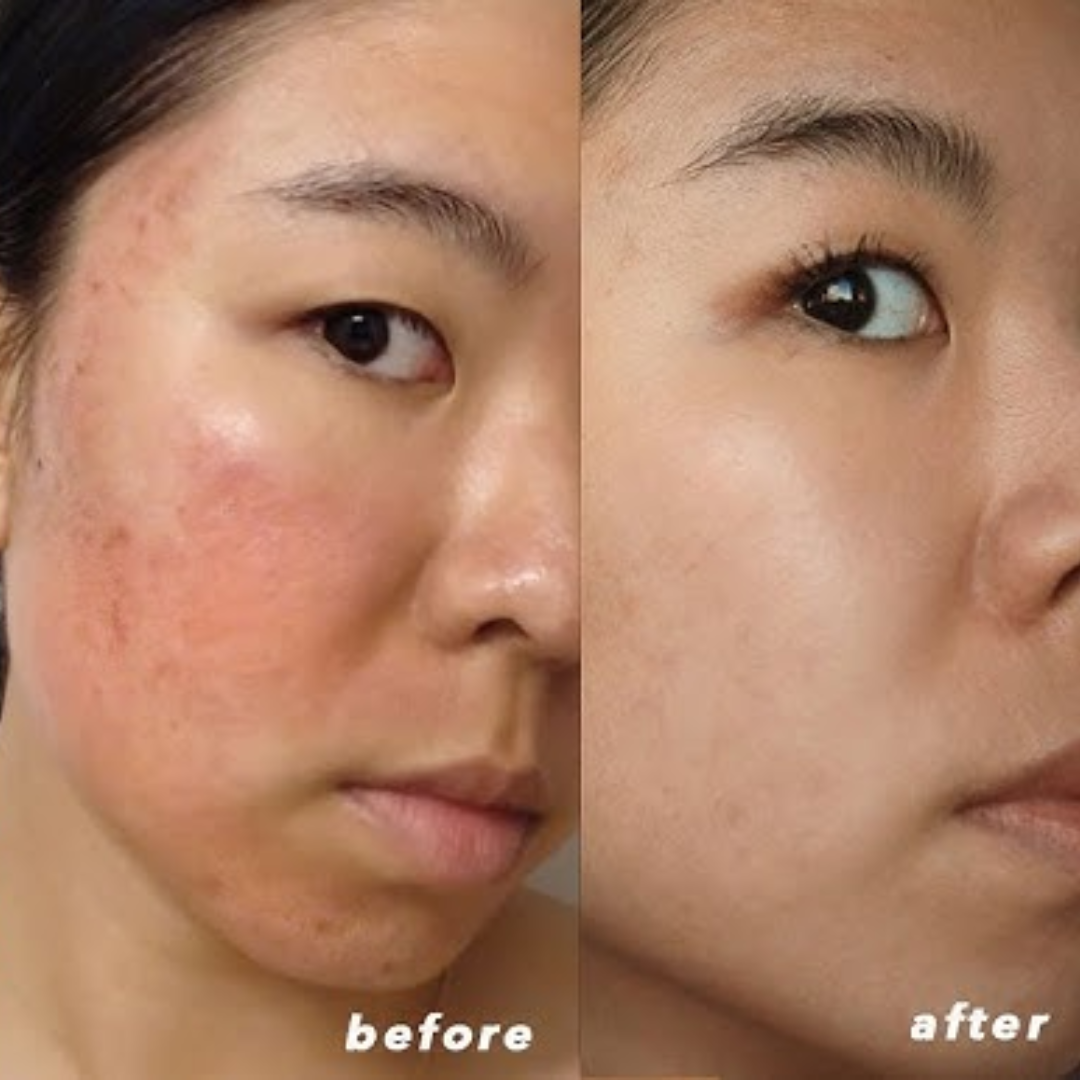 Melaglow Rich Depigmentation & Glow Restoration Cream – Reduces Dark Spots & Pigmentation, Evens Skin Tone, Boosts Natural Glow – Safe & Gentle for Daily Use – For Brighter, Even-Toned Healthy Skin