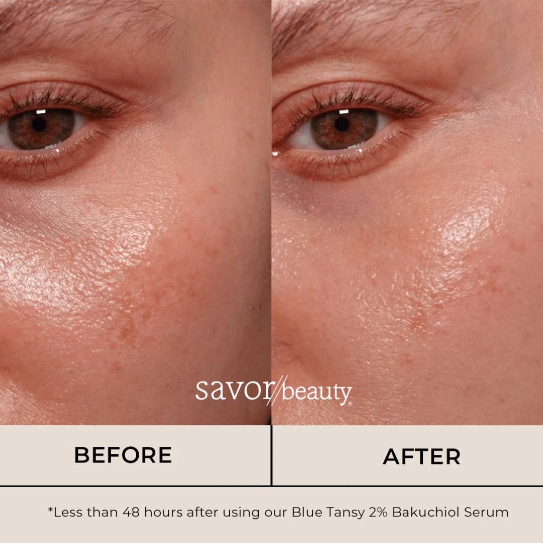 Xpose Full Coverage Foundation & Muse C Brightening Vitamin C Serum | Complete Skin-Perfecting Duo for Flawless, Radiant Skin