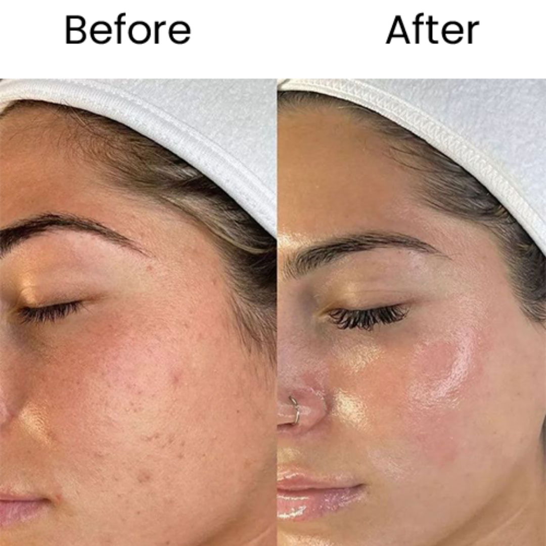 Melaglow Rich Depigmentation & Glow Restoration Cream – Reduces Dark Spots & Pigmentation, Evens Skin Tone, Boosts Natural Glow – Safe & Gentle for Daily Use – For Brighter, Even-Toned Healthy Skin