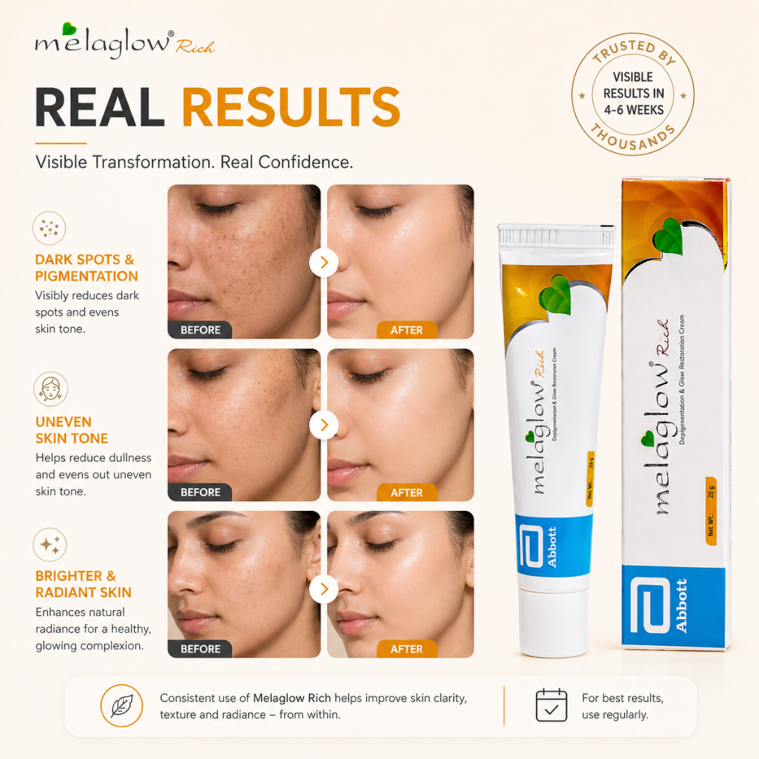 Melaglow Rich Depigmentation & Glow Restoration Cream – Reduces Dark Spots & Pigmentation, Evens Skin Tone, Boosts Natural Glow – Safe & Gentle for Daily Use – For Brighter, Even-Toned Healthy Skin