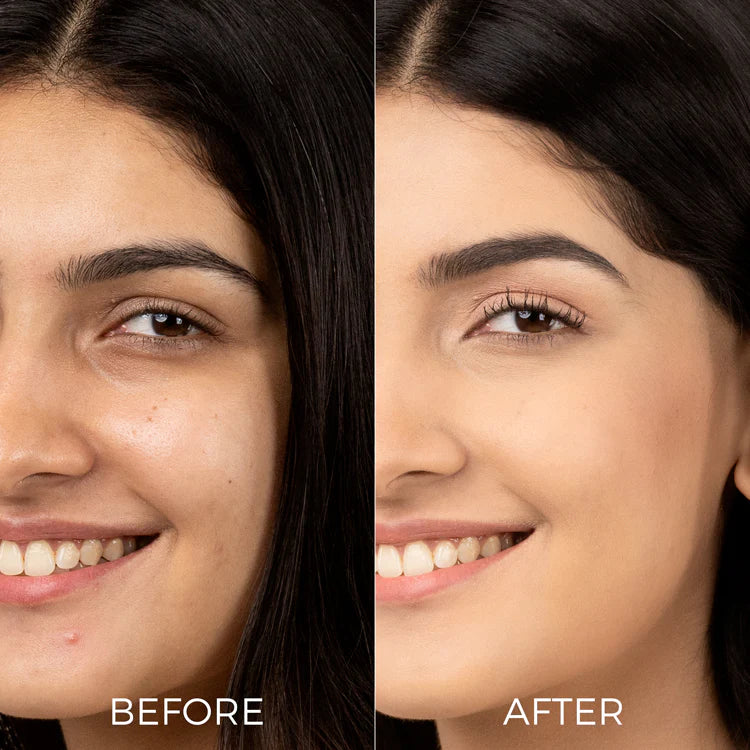 Xpose Full Coverage Foundation & Muse C Brightening Vitamin C Serum | Complete Skin-Perfecting Duo for Flawless, Radiant Skin