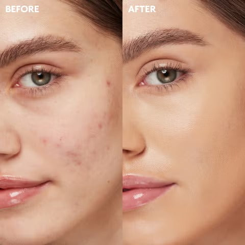 All in one High Coverage Tender Cream | Conceal, Cover & Hydration | Light weight & long-lasting | For all Skin Types